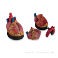 Enlarged Heart Anatomy Model